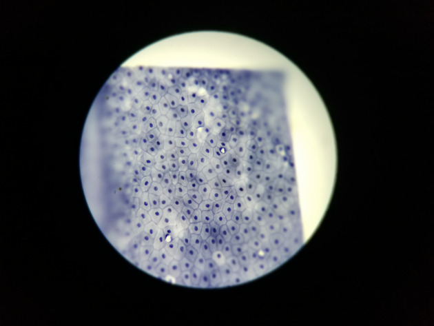 Simple Squamous Epithelium Slides - Simple Squamous Epithelium 01 100X